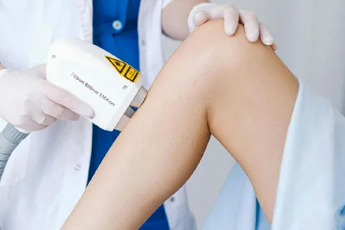 Laser Hair Removal